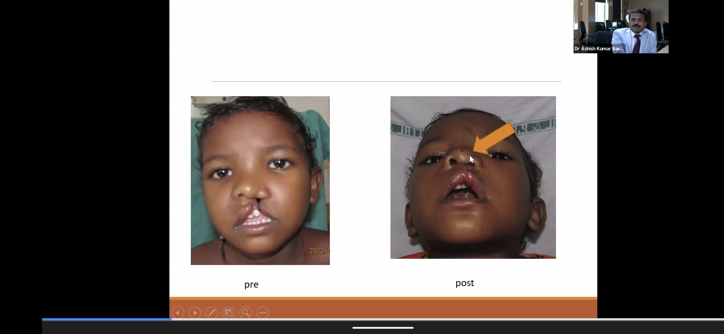 cde-on-basics-in-orthodontics